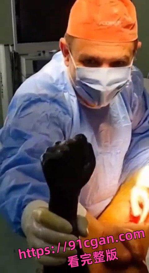 猎奇！拳头形状大玩具从屁股里拔出来的时候医生都憋不住笑了！-4