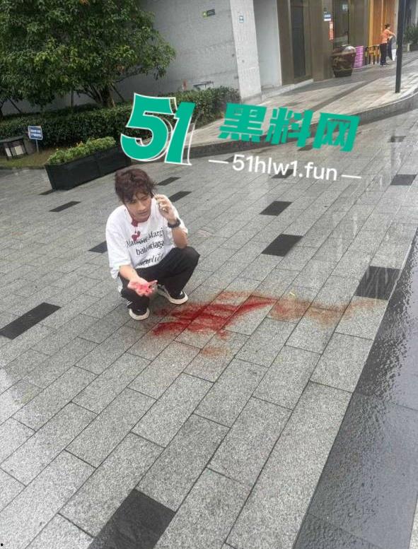 杭州男模【江江】自称网络乞丐，讹上谁就不放过不断纠缠，最终遭人暗算暴打脑袋开瓢。-10