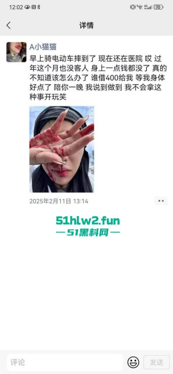 卖惨惯犯纹身妹，骑电瓶车出车祸惨遭破相朋友圈无奈卖身求钱就医，骚货的卖身已成习惯。-8